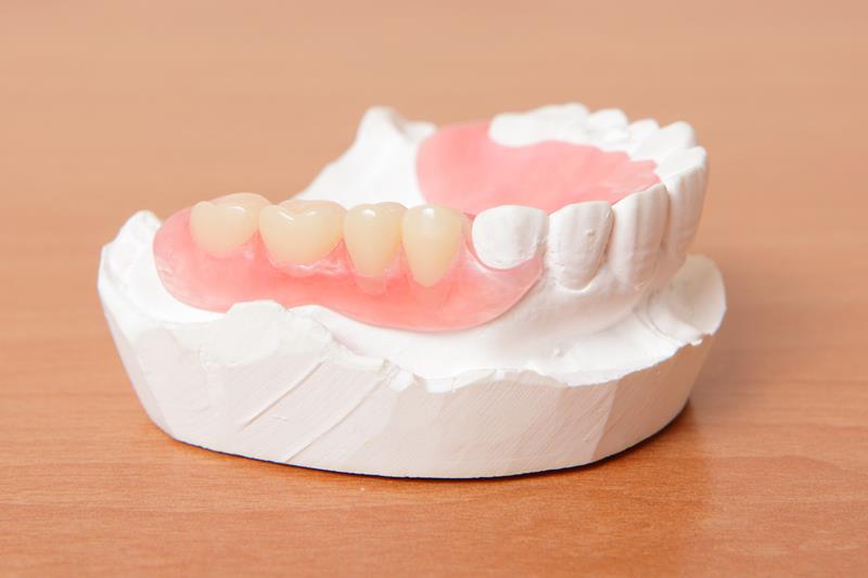 Before And After Partial Dentures: How It Really Feels?